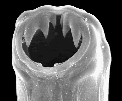 hookworms3.jpg